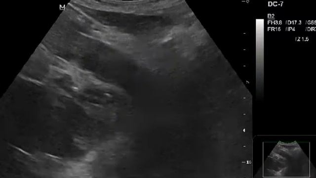 Патология ОБП 2 смотреть онлайн