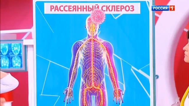 О самом главном. Рассеянный склероз смотреть онлайн