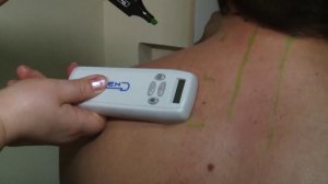 СКЭНАР. Шейно воротниковая зона в ИДР. Часть 1