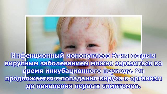 Сколько длится заразный период у гриппа, ветрянки и других заболеваний смотреть онлайн