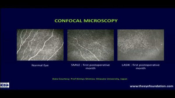 AIOC2018 - GP102 - Topic - Ophthalmic Debate ( Cataract & Refractive – I ) - Dr.Gitansha Sachdev