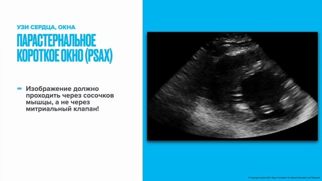 Как делать УЗИ если вы не умеете делать УЗИ (часть 1)