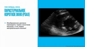 Как делать УЗИ если вы не умеете делать УЗИ (часть 1)