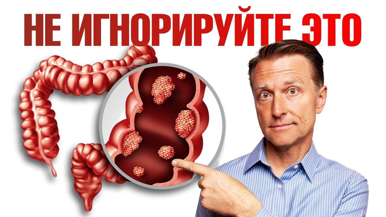6 ранних признаков рака толстой кишки. НЕ ПРОПУСТИ смотреть онлайн