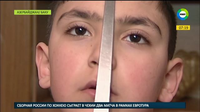 Мальчик-магнит из Баку. «Я подумываю стать психологом. С помощью магнита можно гипнотизировать». смотреть онлайн