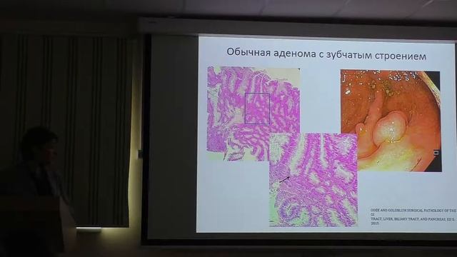 15 Крайнова ЕА Биопсийная диагностика и исследование материала эндоскопических новообразований резе смотреть онлайн