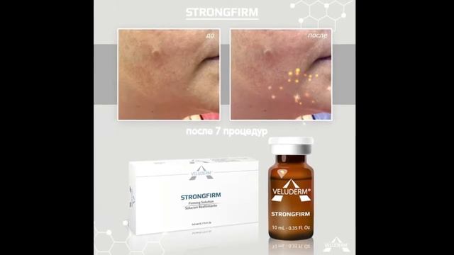 Бустер ревитализация VELUDERM смотреть онлайн