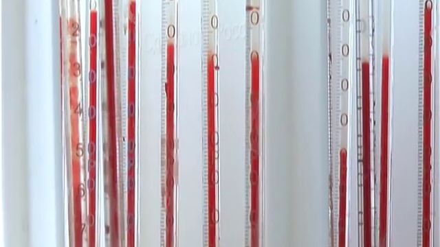 Областная детская инфекционная больница получила новое диагностическое оборудование смотреть онлайн