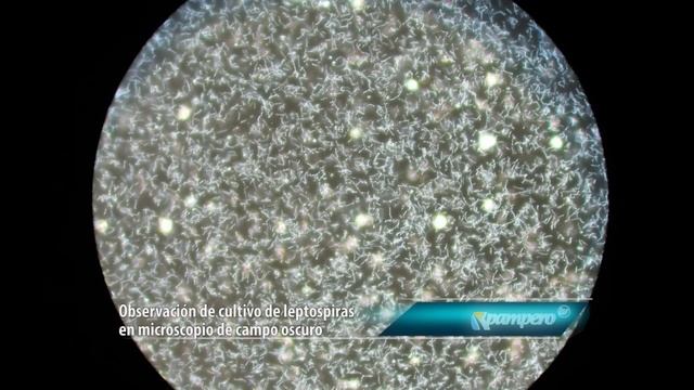 Leptospirosis смотреть онлайн