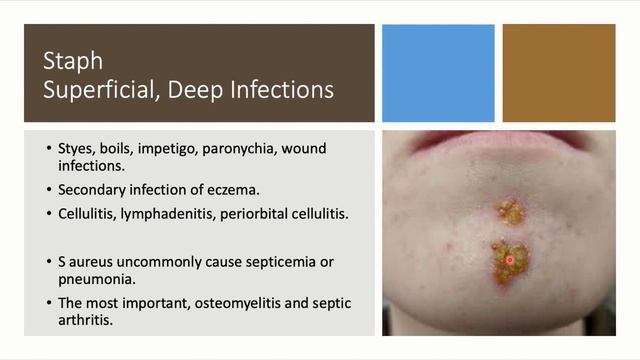 MRCOCH Fundamentals. Pediatric Infection 2 смотреть онлайн