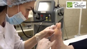 ГИПЕРГИДРОЗ НОГ - уколы от потливости