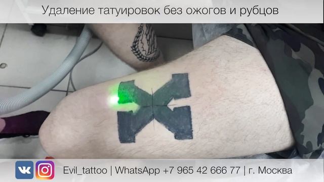 Лазерное удаление татуировки в студии Evil Tattoo. Без травм, ожогов и рубцов. смотреть онлайн