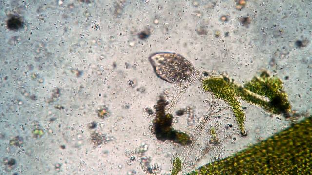 Vital activity of ciliate Stylonychia mytilus in the microcosm in the microscope смотреть онлайн