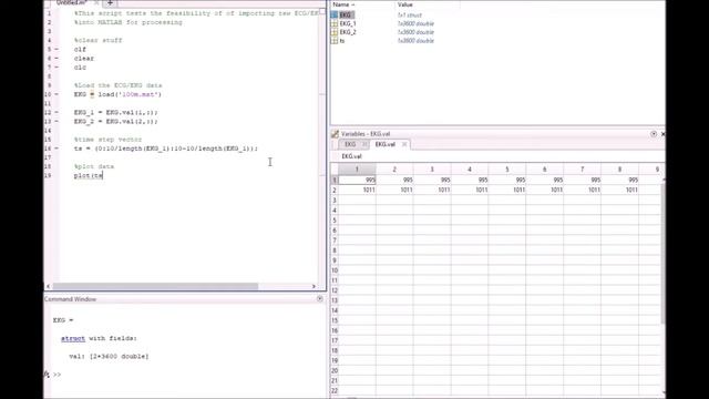 How to code a simple heart beat detector (in Matlab) смотреть онлайн