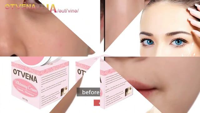 HOT Sale skin care OTVENA natural moisture anti freckle instant whitening cream смотреть онлайн
