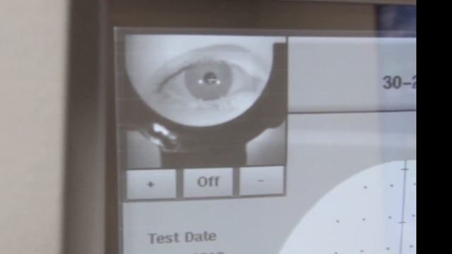 How to do a Visual Field for patients by Dr. Fischer at Laria Eye Care смотреть онлайн