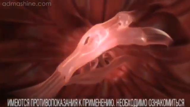 Реклама Нурофен Гель (2012-2013) смотреть онлайн