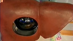 Аспирин токсичен для печени