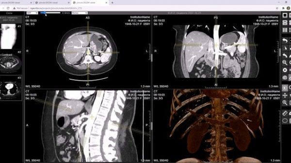 DICOM Web-viewer