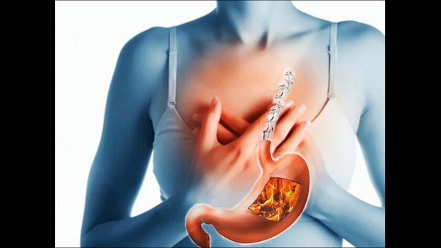 Изжога,пять полезных советов, по предотвращению изжоги...