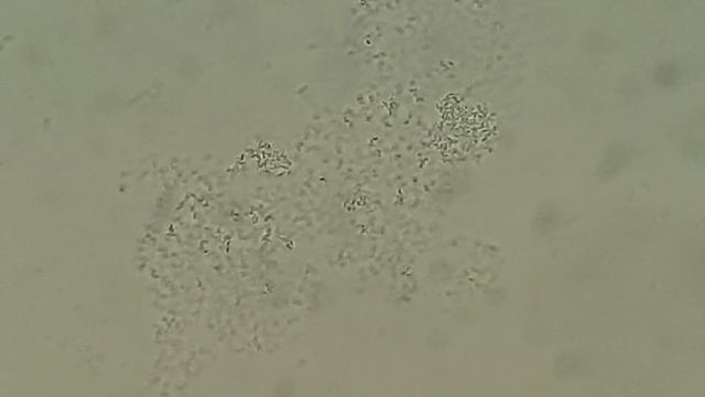 Morganella Morganii Colony Morphology And Microscopy