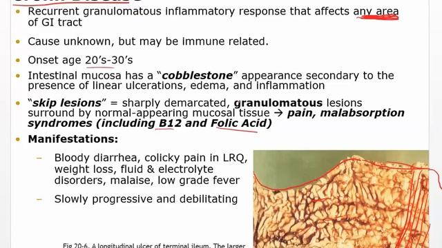 Chapter29 Video Disorders of GI function смотреть онлайн