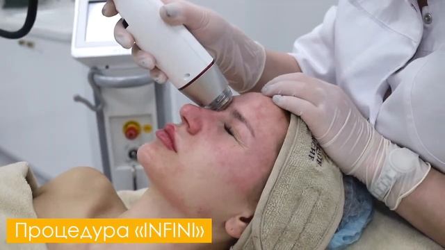 Фракционный микроигольчатый RF лифтинг на INFINI смотреть онлайн