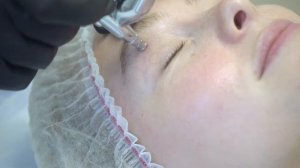 Кислородная процедура Интрасьютикалс (Intraceuticals)