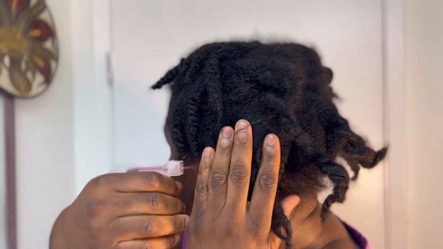 This treatment will prevent alopecia and promote hair growth! No more bald hair.Cloves and hibiscus смотреть онлайн