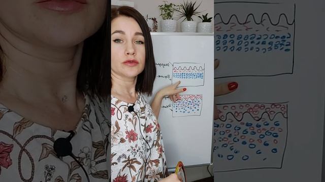Почему брови становятся синими? смотреть онлайн