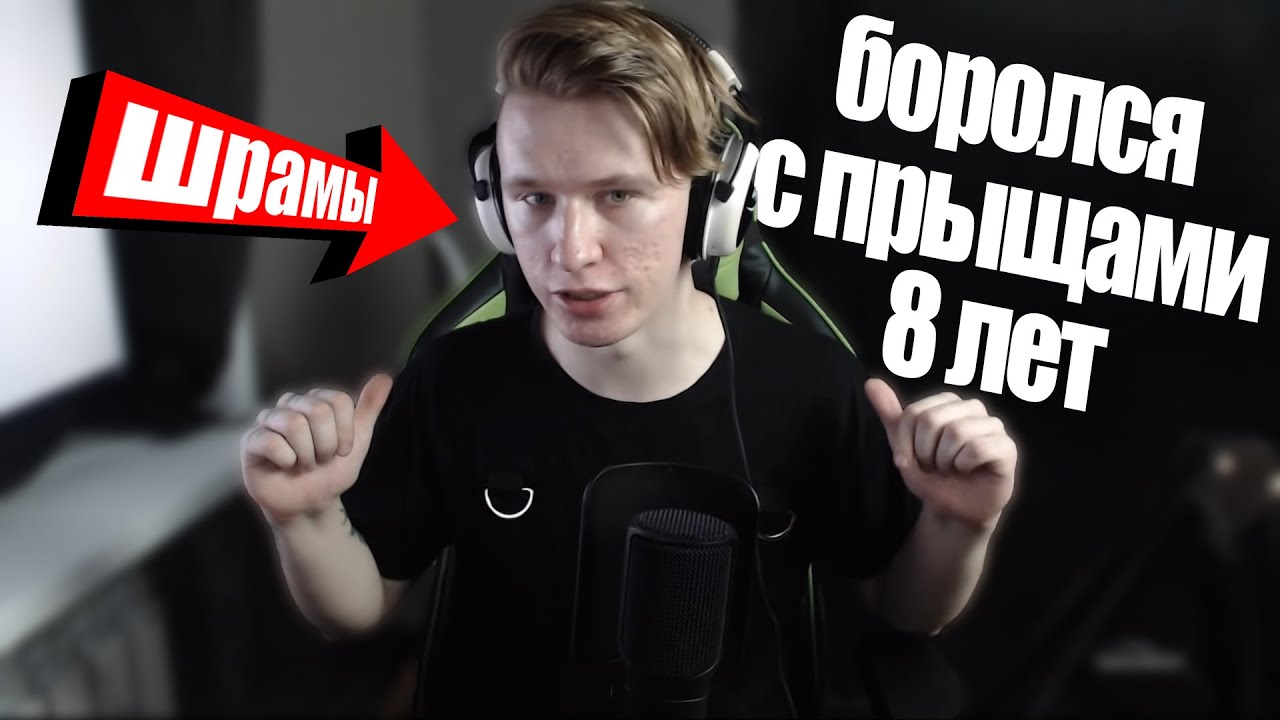 Как избавиться от прыщей и черных точек. Моя ужасная история из жизни как я боролся с акне 8 лет смотреть онлайн