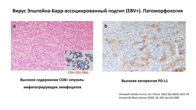 «РАК ЖЕЛУДКА. Новый взгляд на проблему» смотреть онлайн