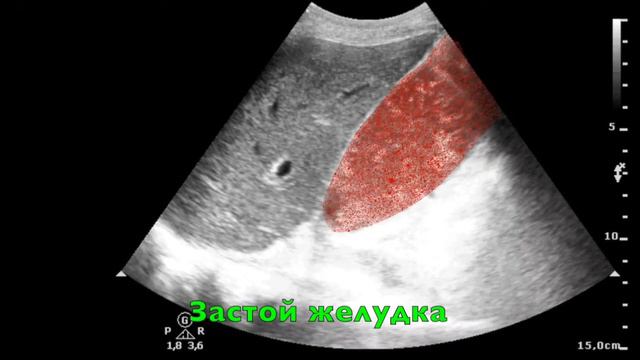 081 - УЗИ - Застой желудка смотреть онлайн