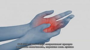 Боль в кисти руки при сгибании