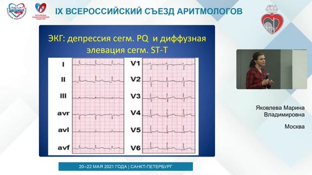 29- «COVID и аритмии: взгляд из красной зоны. » смотреть онлайн