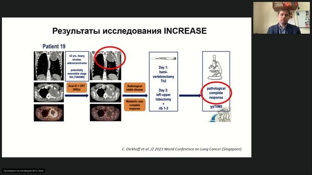Лучшее по материалам всемирной конференции по раку легкого (WCLC) 2023 (вебинар 26 октября 2023)