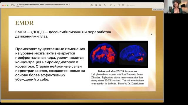 Что такое EMDR терапия?