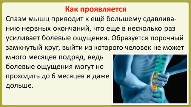 Что такое радикулоневрит и как он лечится? смотреть онлайн