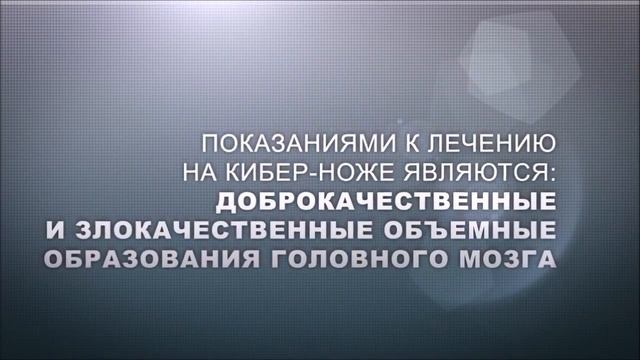 Кибер нож в ЛДЦ МИБС смотреть онлайн
