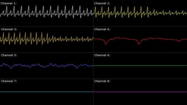 [SNES] Kirby Super Star: Mine Cart Riding - Oscilloscope View смотреть онлайн