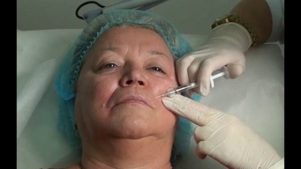 Аристократичный филлер - Princess Filler