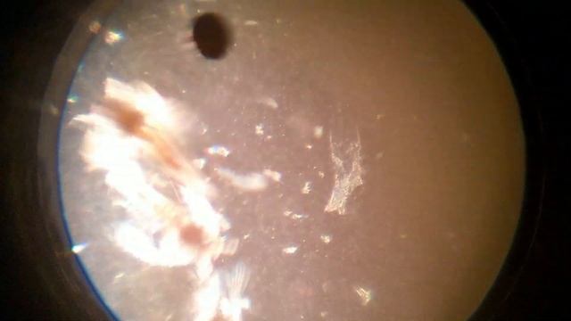 Рачки Артемии Под Микроскопом (Artemia Crustaceans Under The Microscope) смотреть онлайн