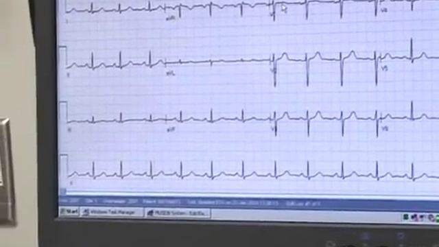 Code STEMI: Heart Attack Survival смотреть онлайн
