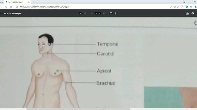 VITAL SIGN / PULSE PROCEDURE смотреть онлайн