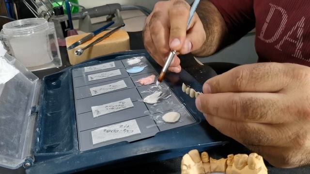 Как быстро перейти на керамическую ВАOT смотреть онлайн