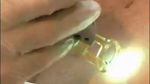 Лазерная эпиляция груди смотреть онлайн