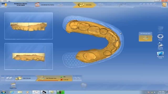 What CEREC File You Need to Transfer to STL file in Russian смотреть онлайн