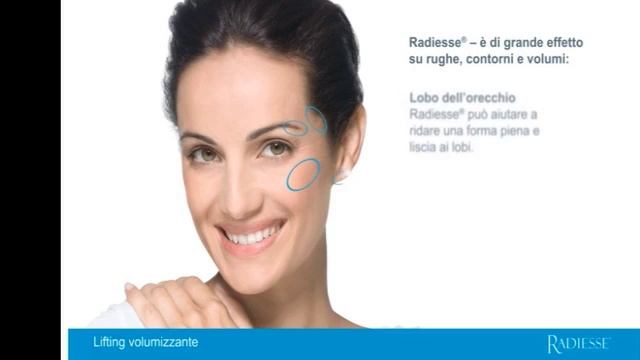 Radiesse® — Il Lifting Liquido смотреть онлайн