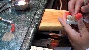 Изготовление  съемного зубного протеза