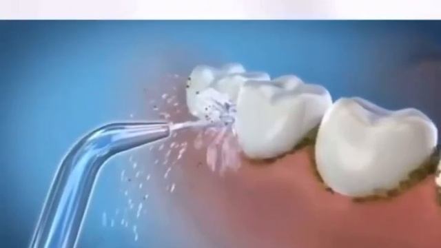 Инструкция по пользованию ирригатором. смотреть онлайн